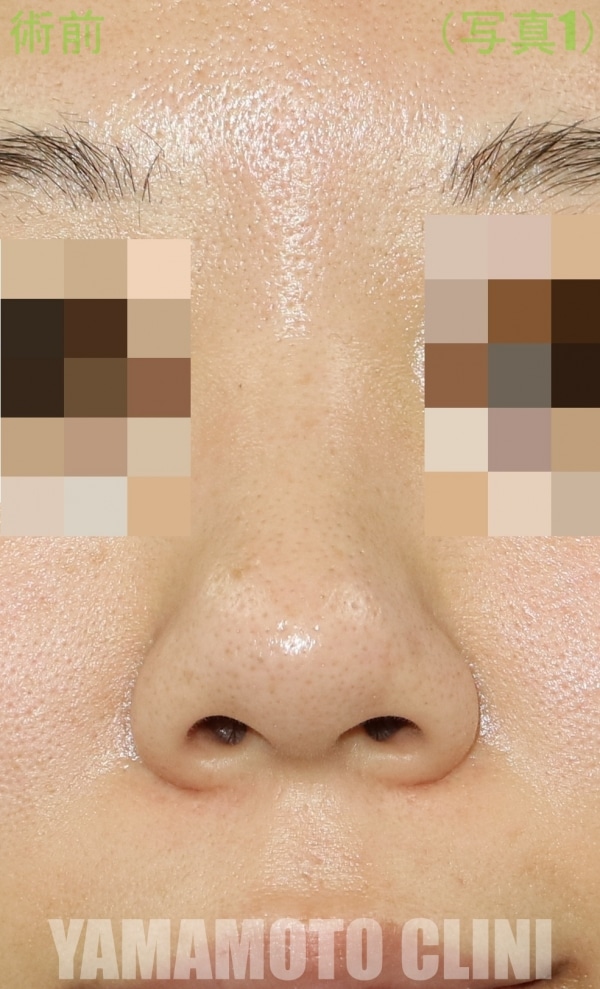 Before